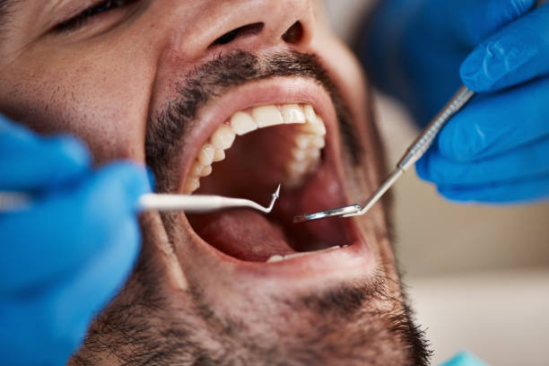 Best Mobile Emergency Dentist in Teague, TX