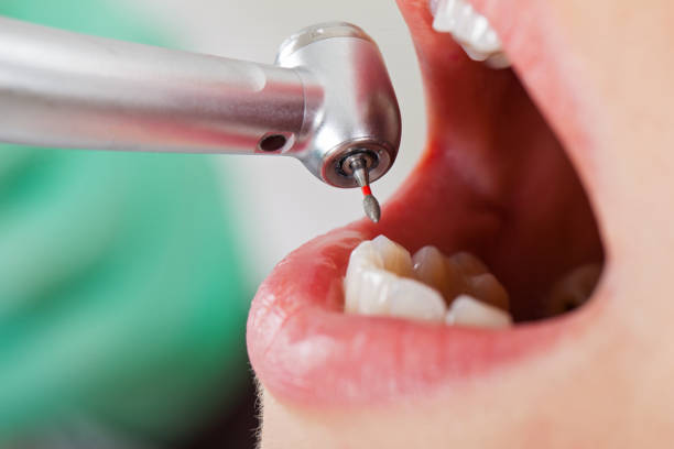 Best Pediatric Emergency Dentist in Teague, TX